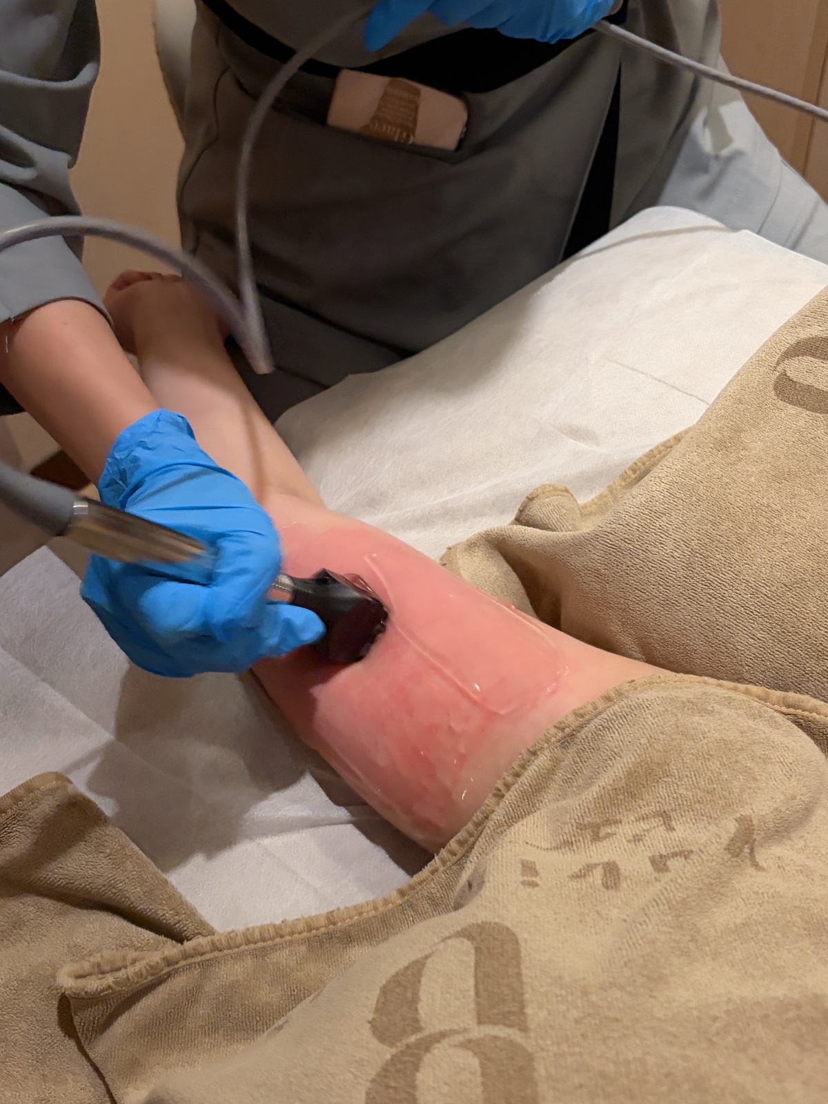 Body contouring treatment in progress
