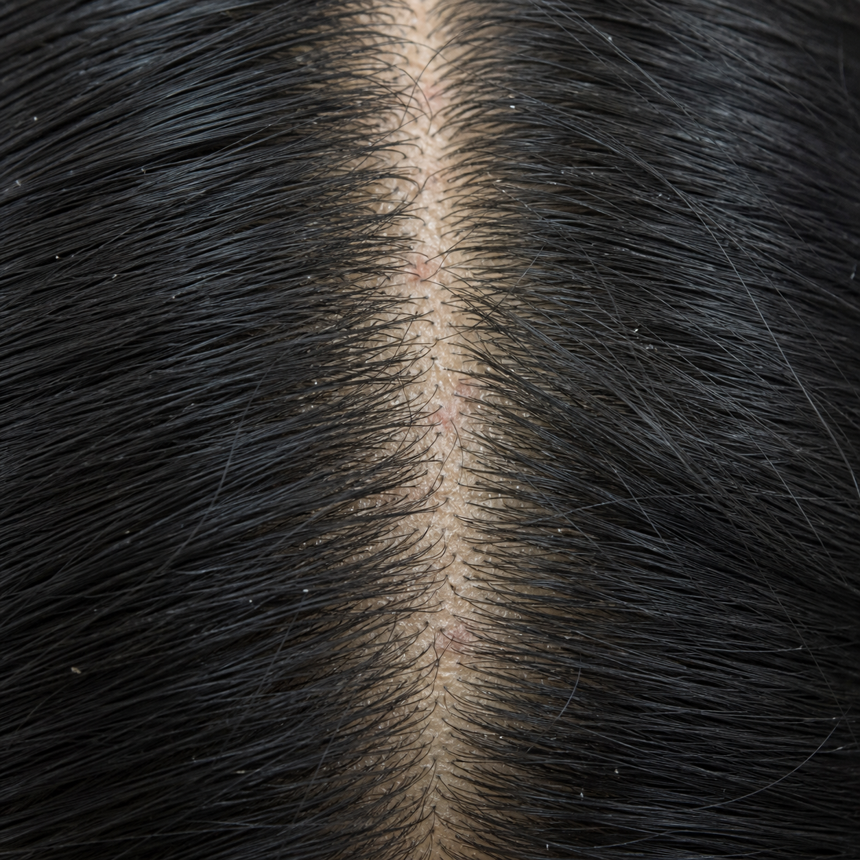 Trichoscope image showing scalp before treatment
