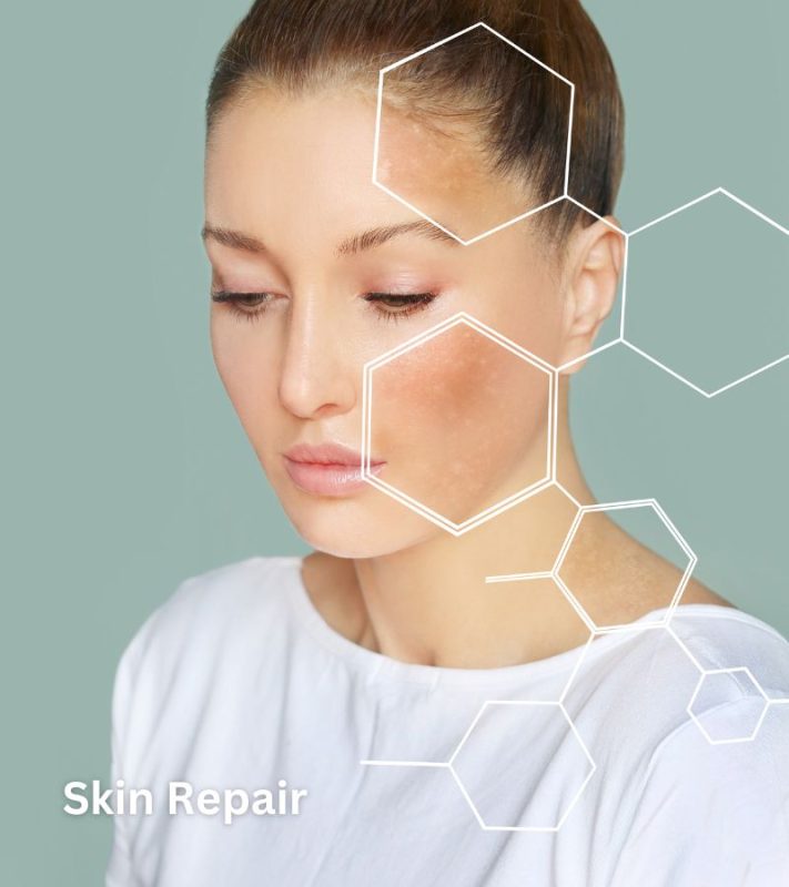 Skin Repair
