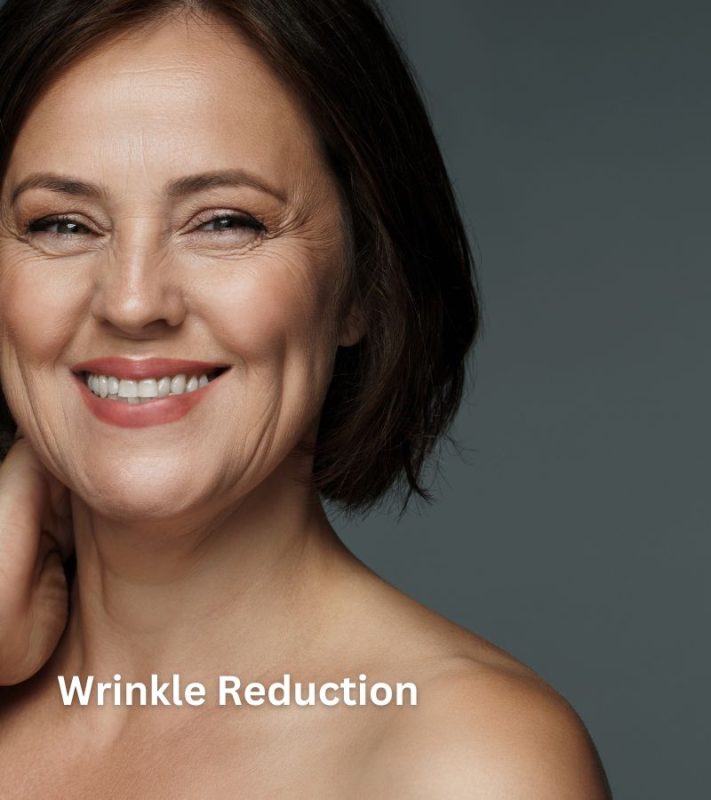 Wrinkle Reduction
