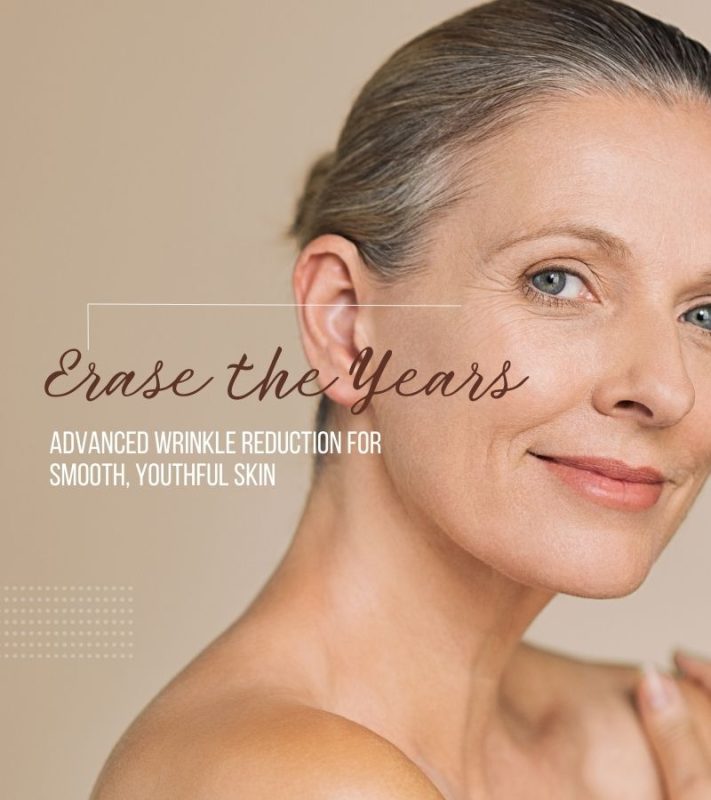 Wrinkle Reduction